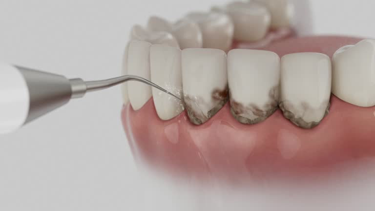 Trusted Tooth Extraction service in Perryopolis, PA - Dentist Open Now